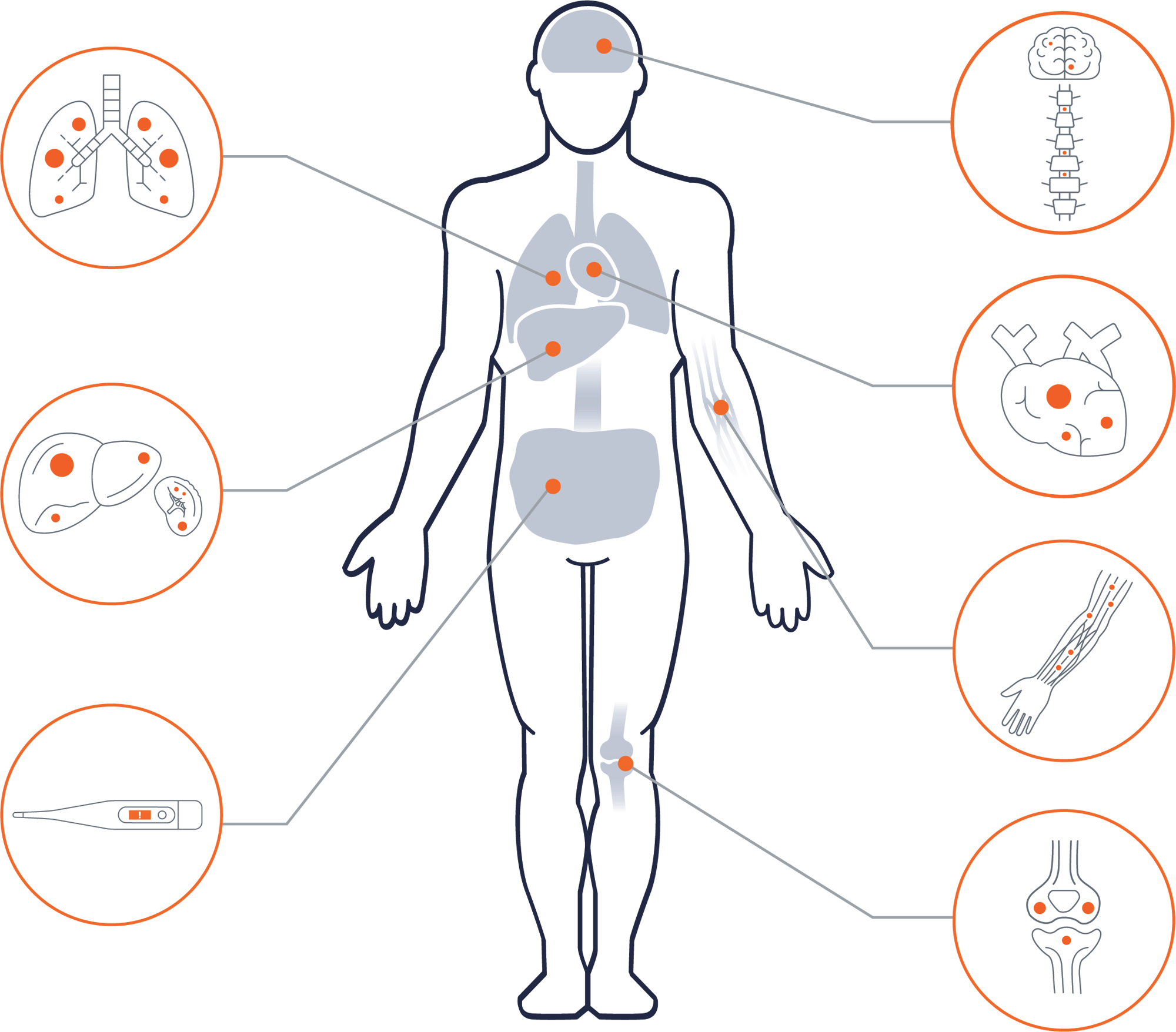 body_diagram